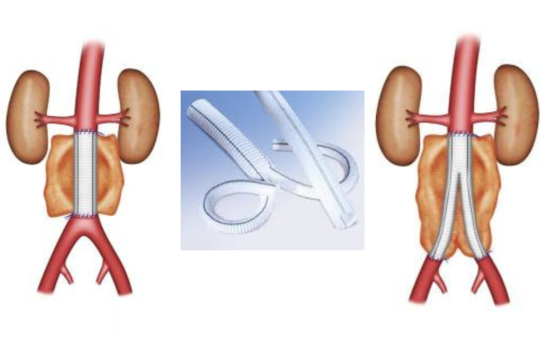 prothese synthetique speciale